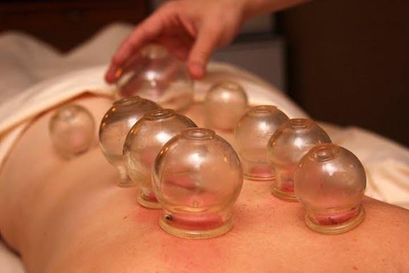 fotocupping